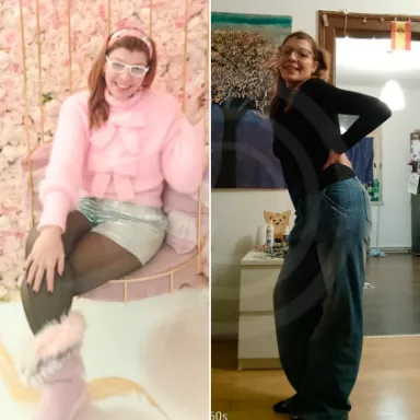 Gastric Sleeve