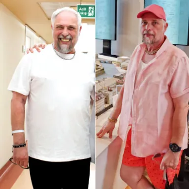 Gastric Sleeve