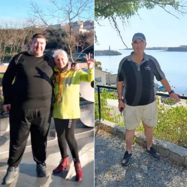 Gastric Sleeve