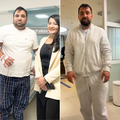Gastric Sleeve