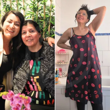 Gastric Sleeve