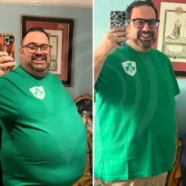 Gastric Sleeve