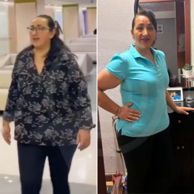 Gastric Sleeve
