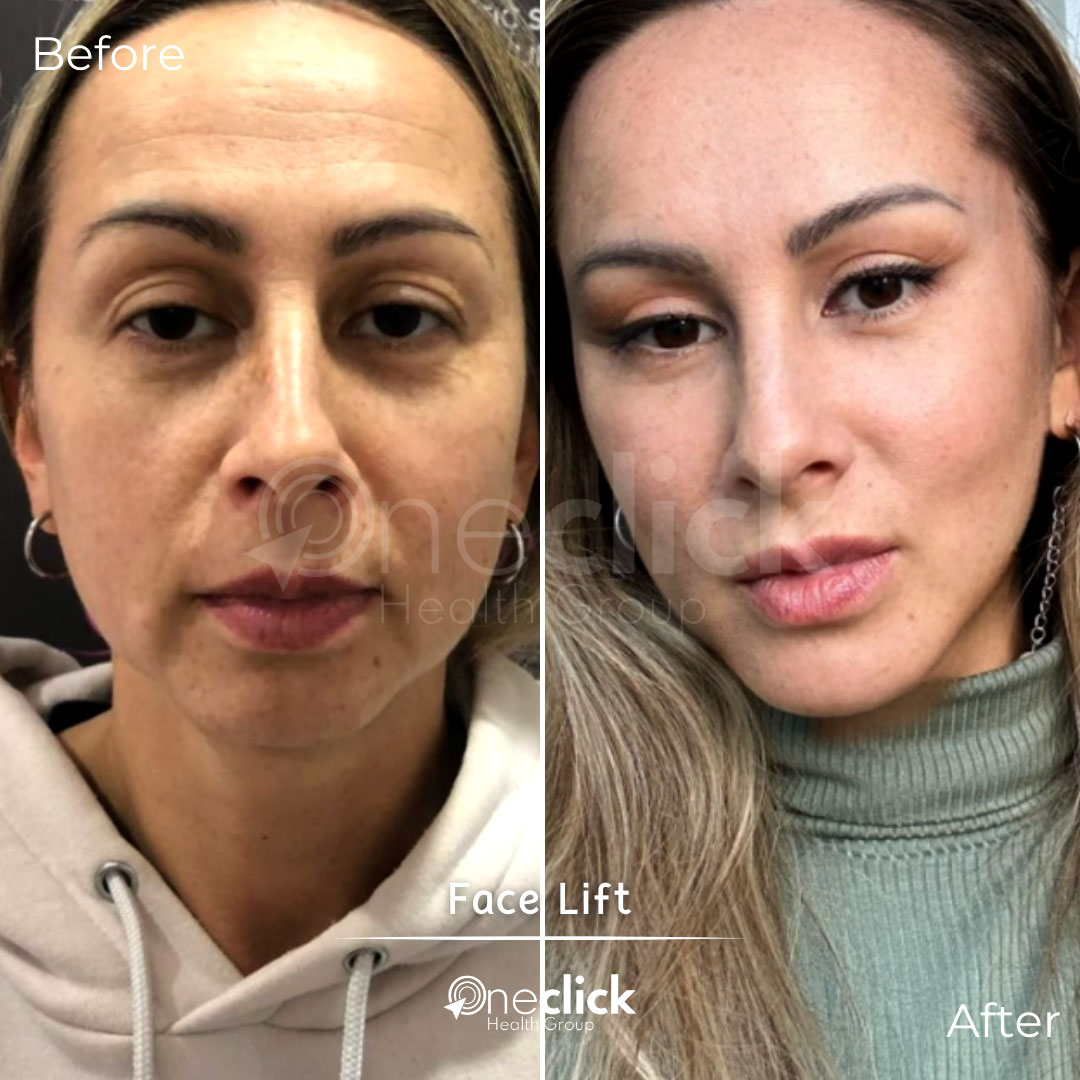 Plastic Surgery