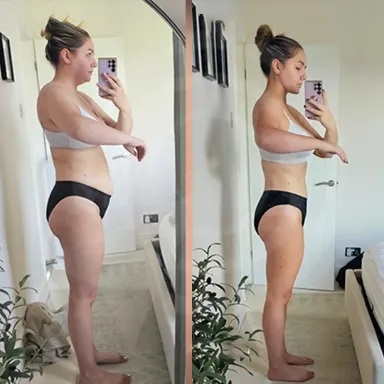 Liposuction
